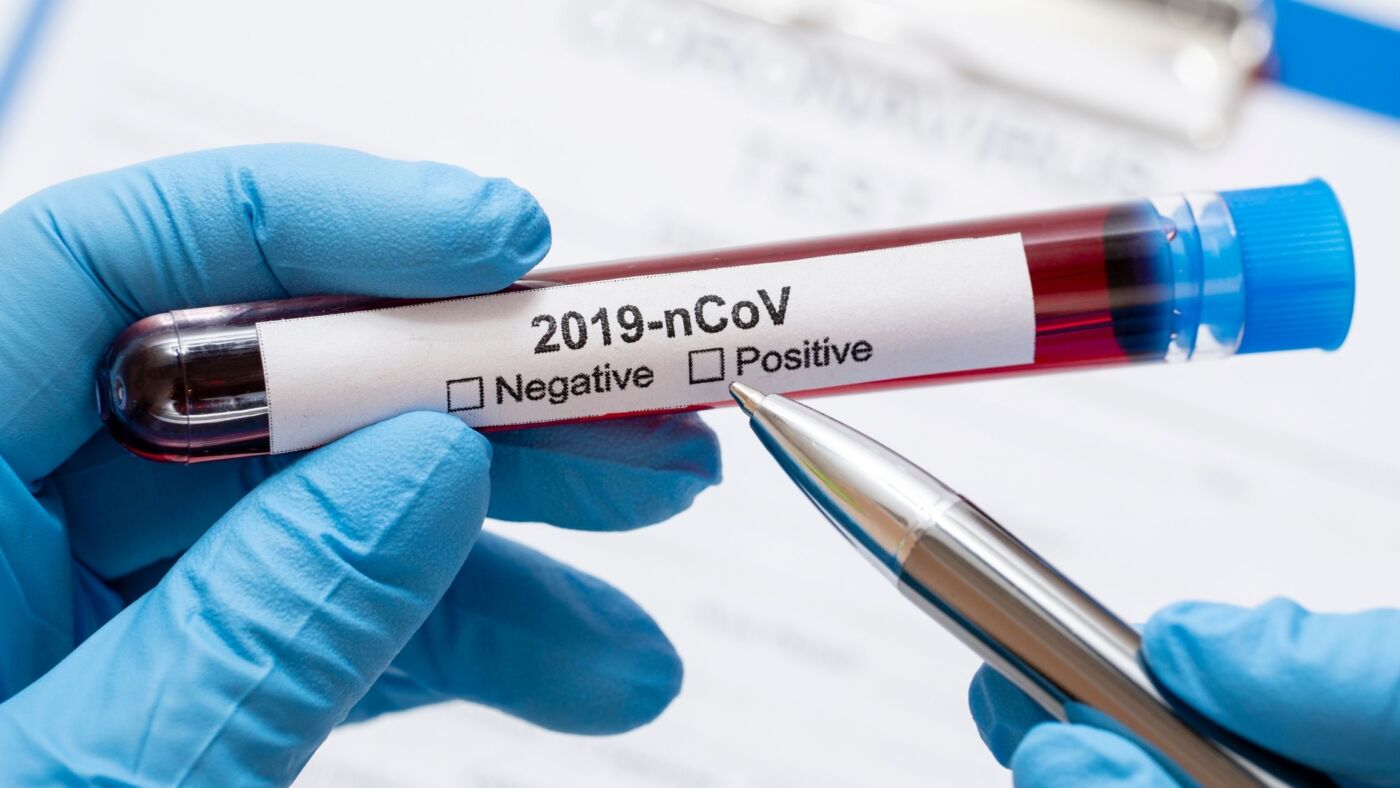 COVID-19 PCR test